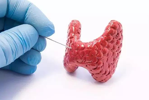 甲状腺疾病，包括甲状腺功能减退和甲状腺功能亢进，自古以来就是反复被医学研究人员研究的疾病